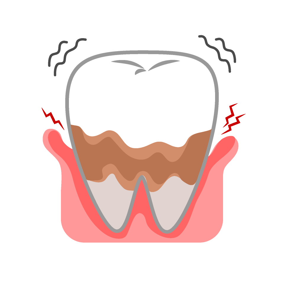 歯茎が腫れた、痛い
