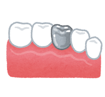 銀歯を白くする相談がしたい