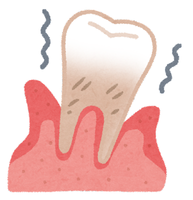歯ぐきの異常（腫れ、出血、痛みなど）