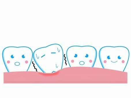 歯がグラグラする