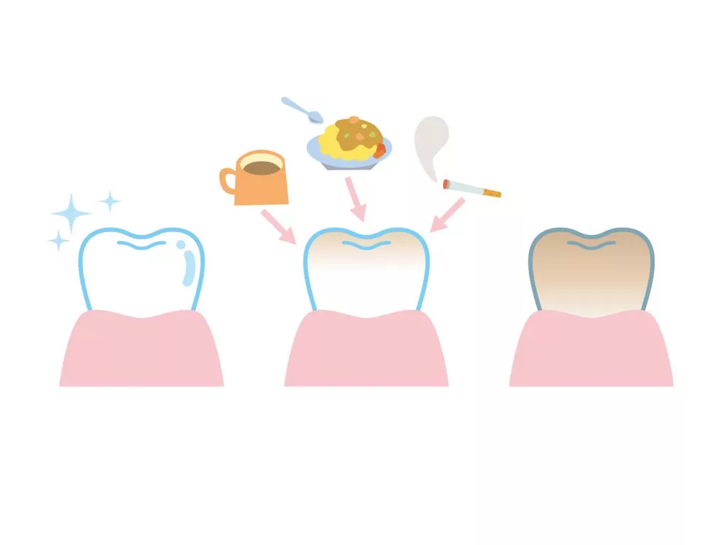 歯の色味や着色が気になる