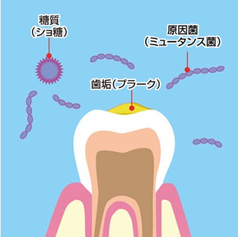 歯が痛い