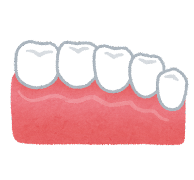 歯周組織再生外来