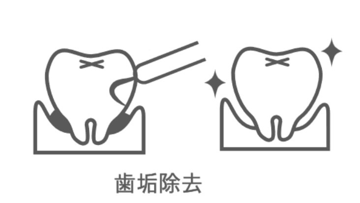 保険での治療をご希望の方