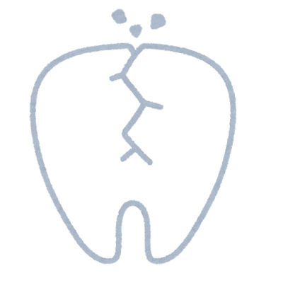 歯が欠けた・割れた・取れた